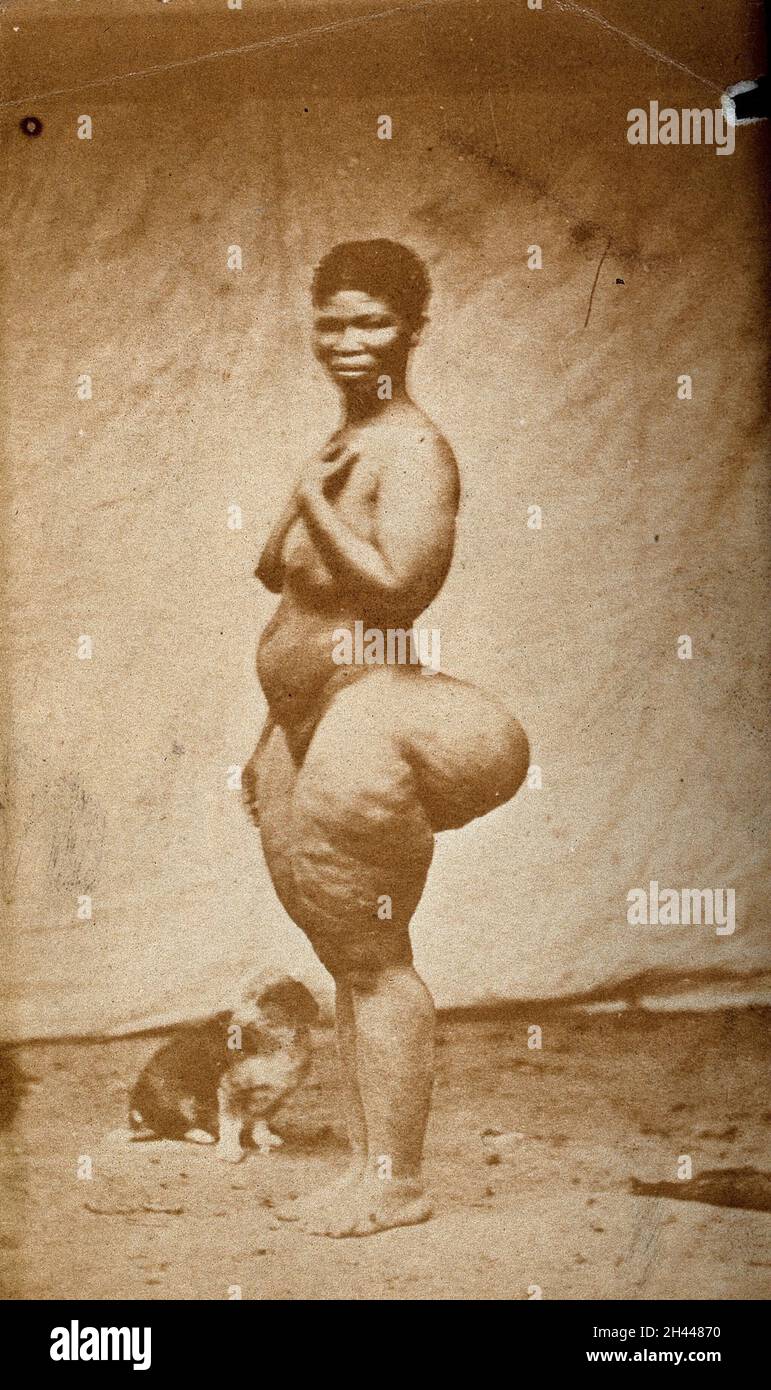 Standing woman full length side view with enlargement of the buttocks steatopygia photograph 2