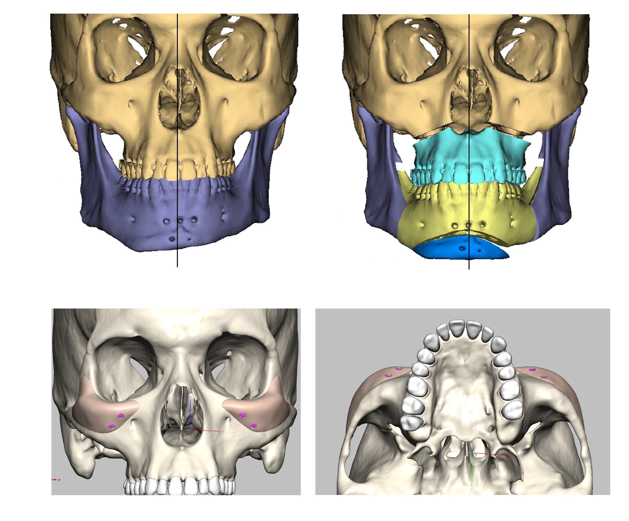 Surgery plan