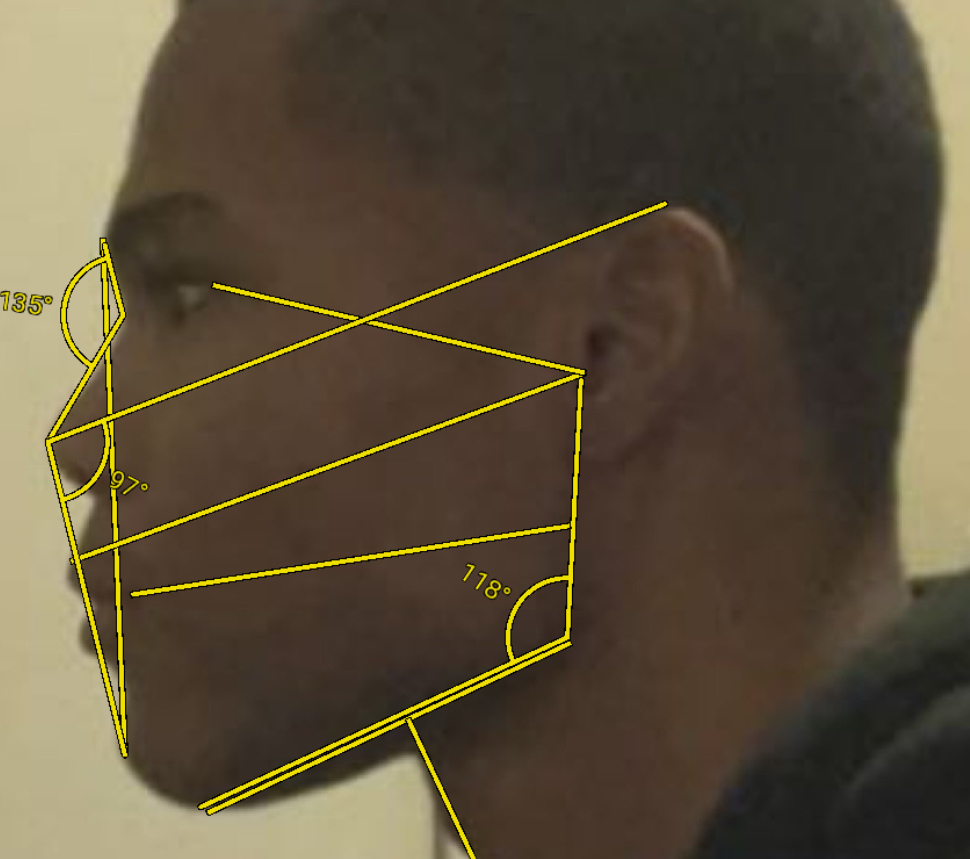 CachedImage CachedImage