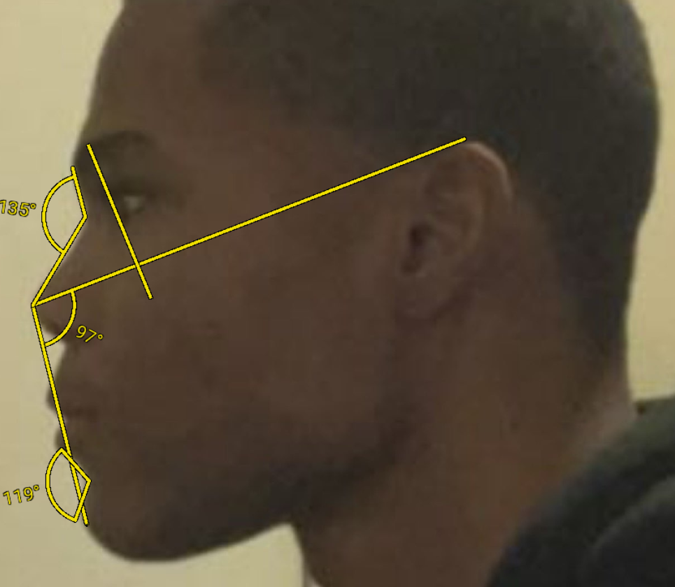 CachedImage CachedImage