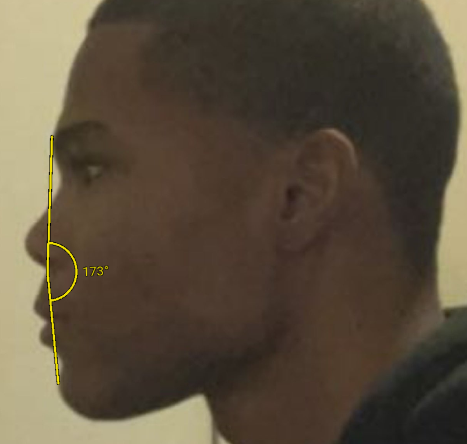 CachedImage CachedImage