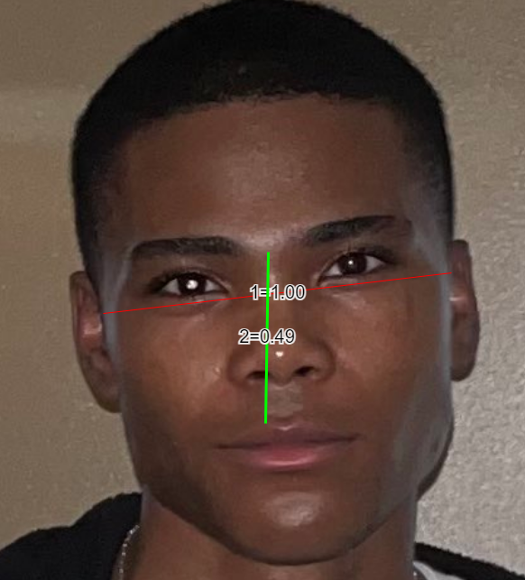 CachedImage
