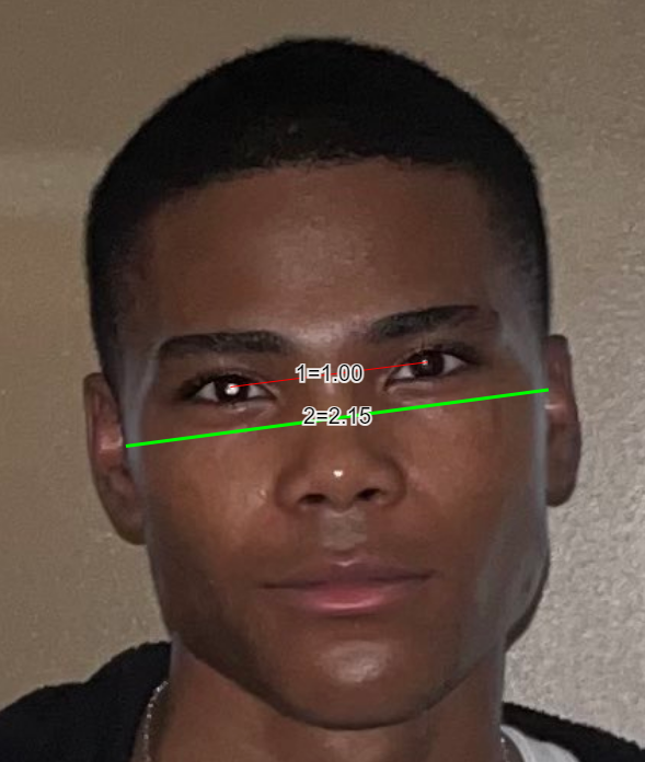 CachedImage