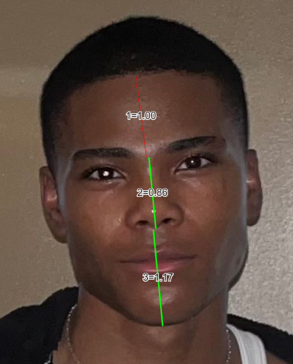 CachedImage