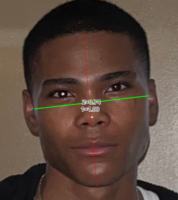 CachedImage