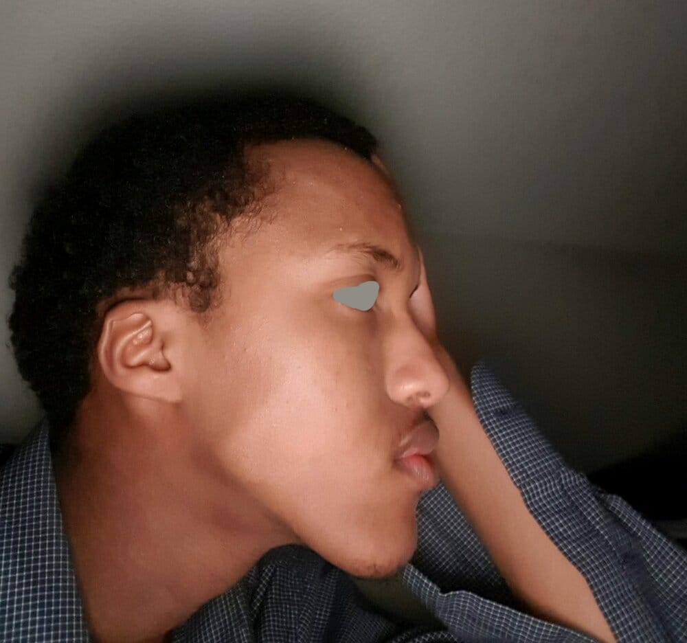 Toodlydood