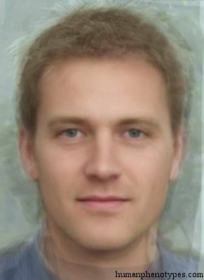Tronderm Tronderm