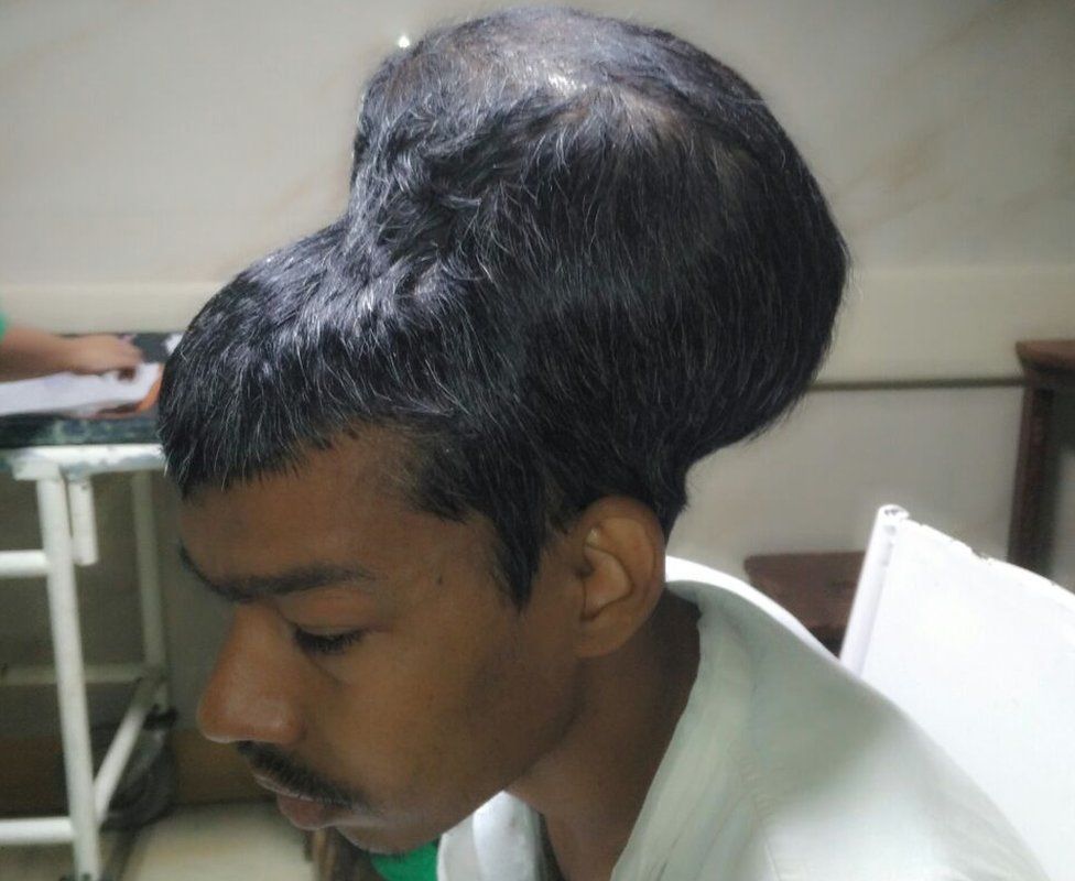 100131505 tumour