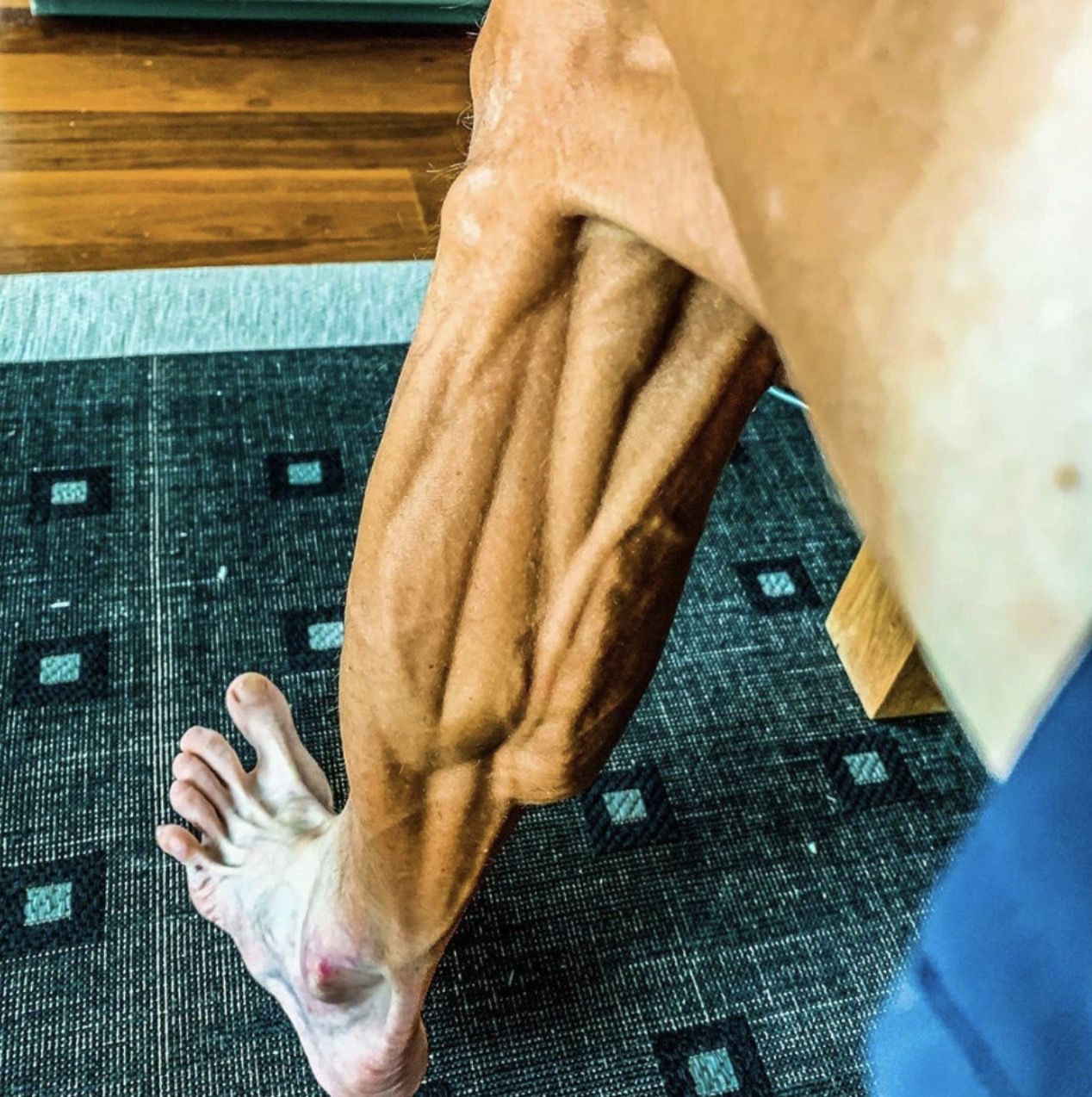 Leg11570793268