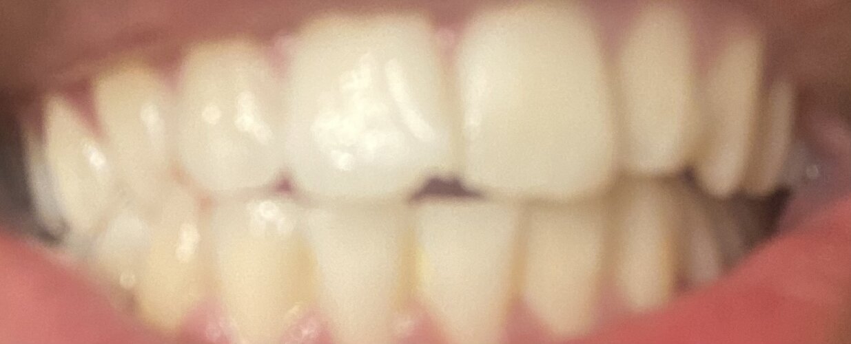 IMG_2843.jpeg