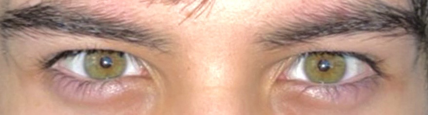 Green eyes