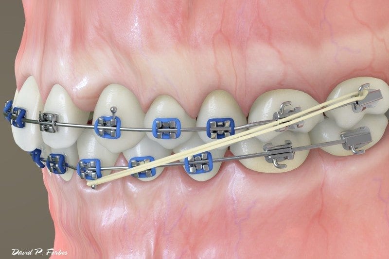 Elastics 2 800x534