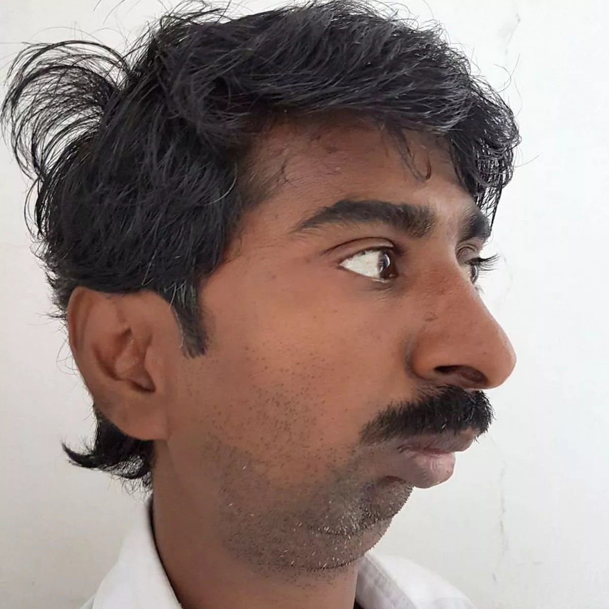 Indian chinless man