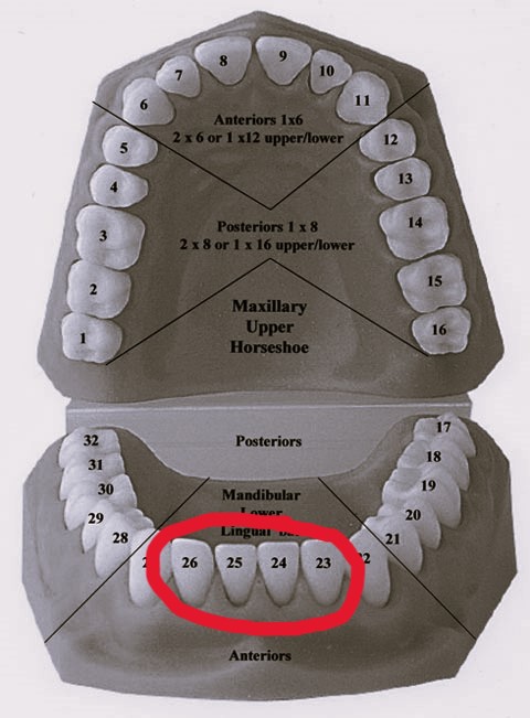 Toothdiaghram