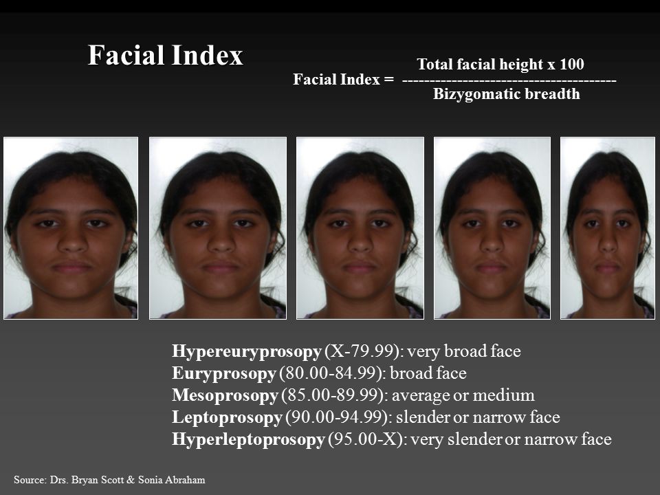 FacialIndexHypereuryprosopyX 7999 verybroadface
