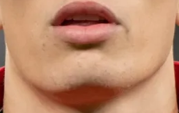 Epyoflx1h9dklbnan9qy