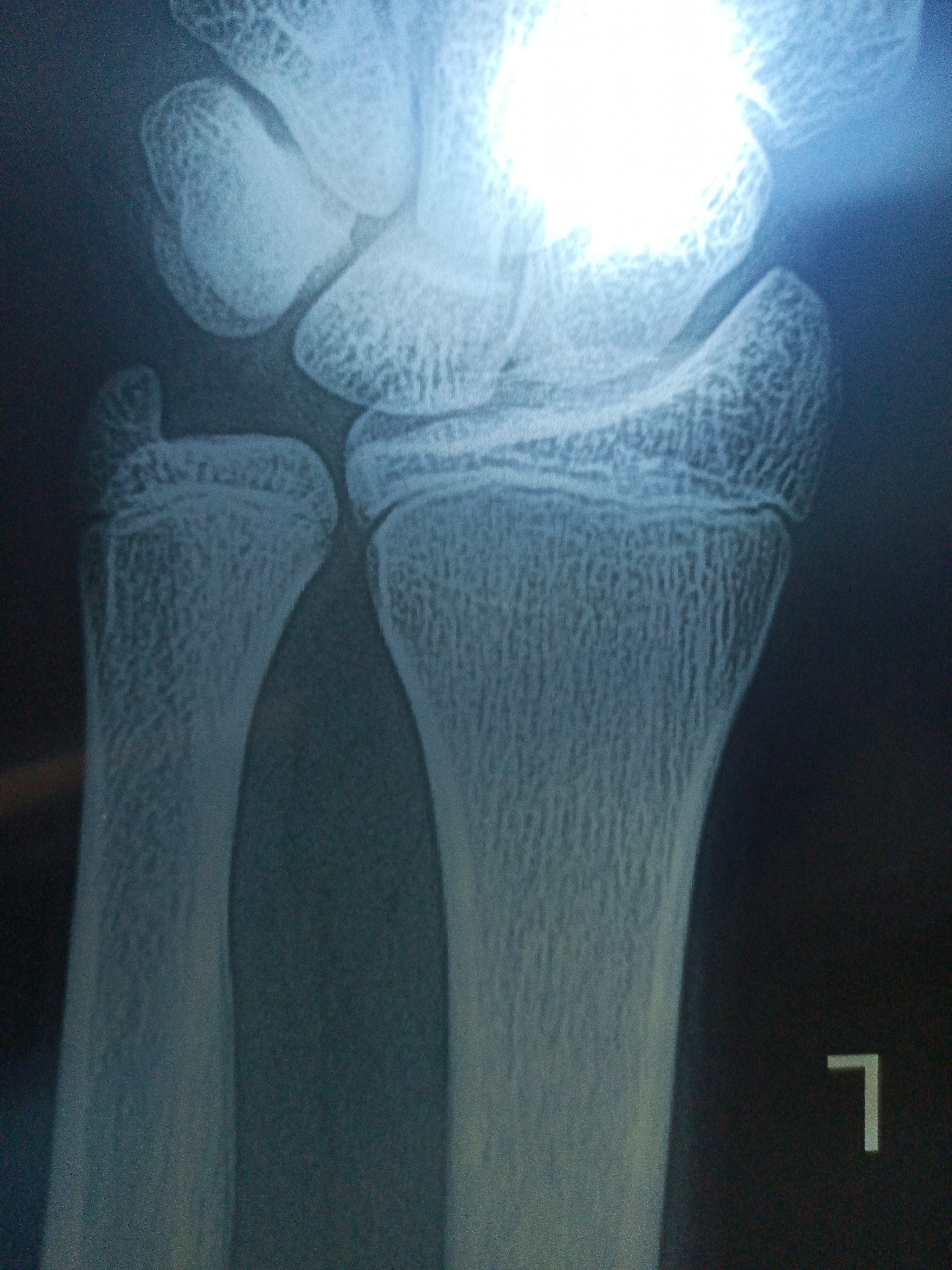 IMG 20240211 112213 291