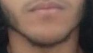 Chin