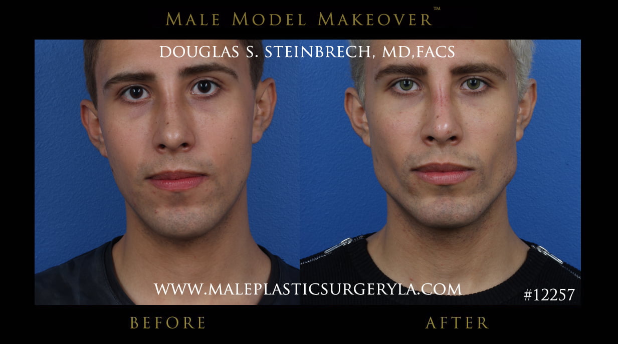 Male model makeover mps la 2 1
