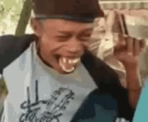 Lel teeth 1 Lel teeth 1