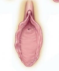 Hymen12