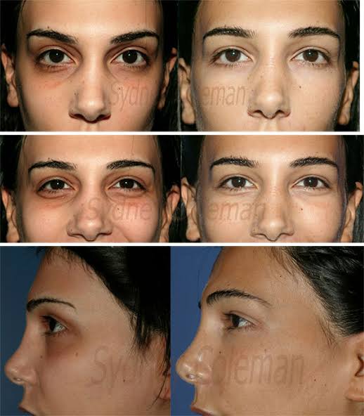 4F45B47F 3474 4D0A 9AF9 214DA77B82D3