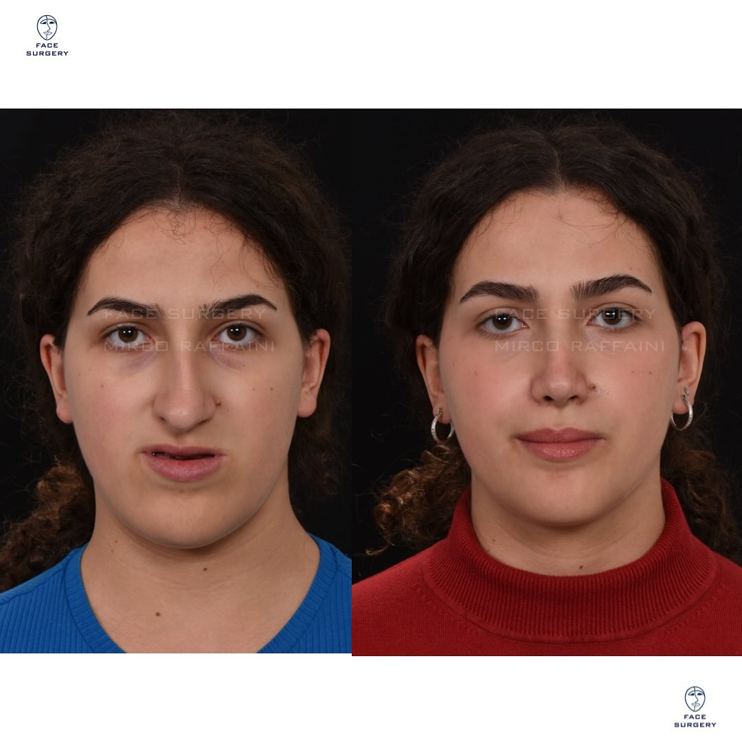1708485611644