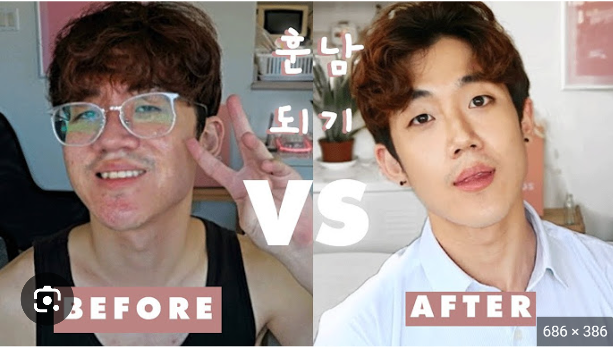 Before and After