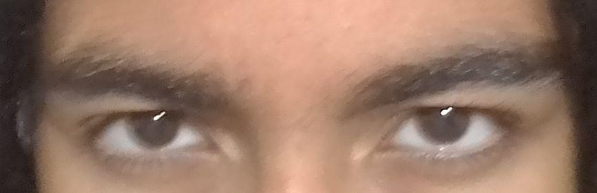 Eye area