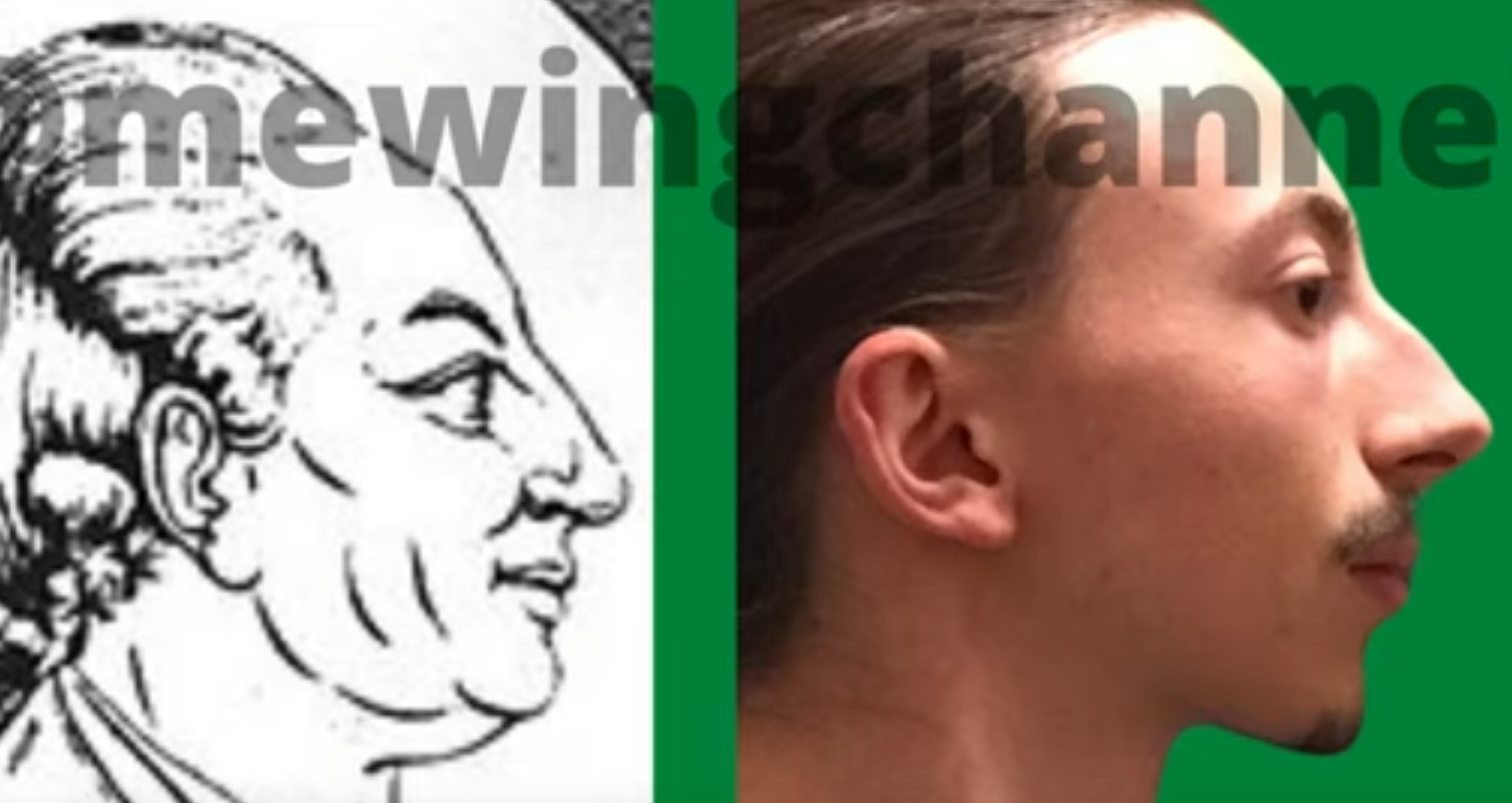 Insane Looksmax ascension truecel to HTN | Looksmax.org - Men's Self ...