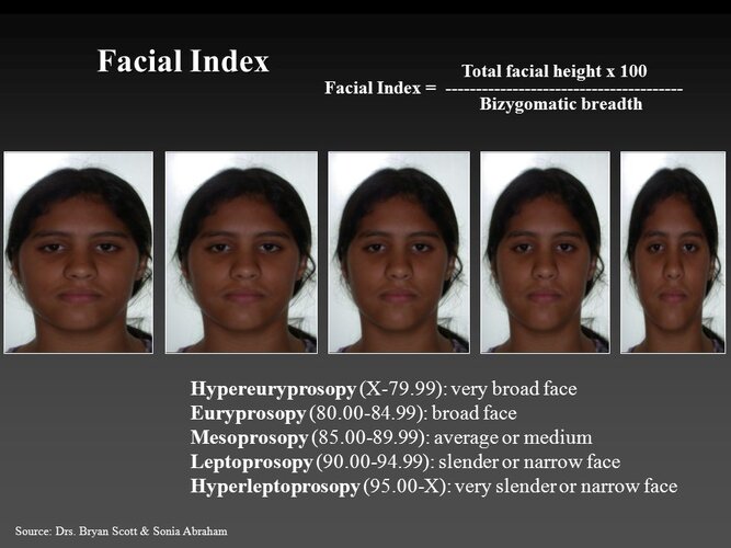 Facial+Index+Hypereuryprosopy+(X-79.99)_+very+broad+face.jpg