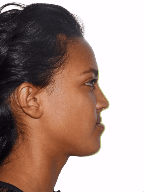 Casevid1.gif