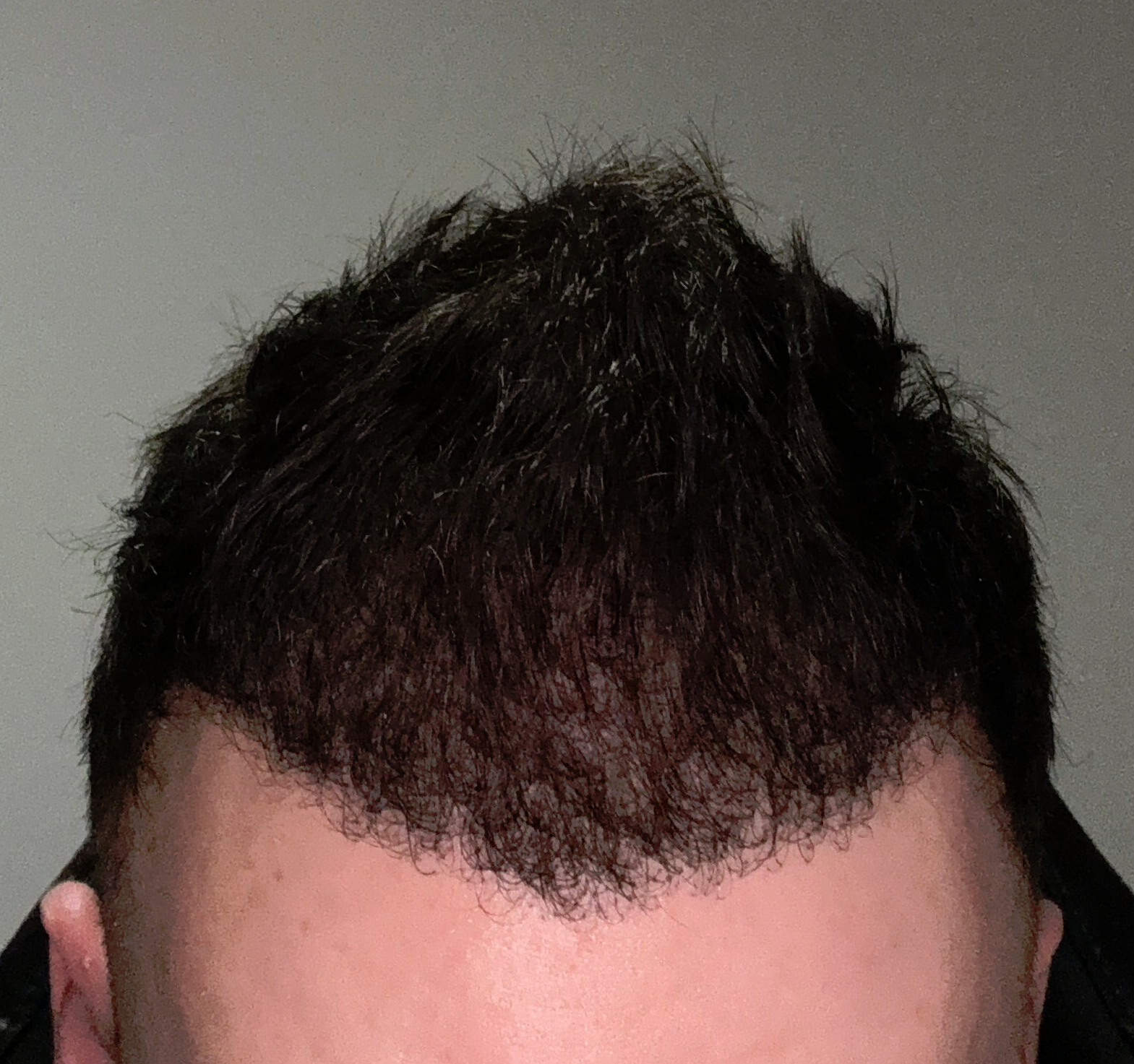 1709502574521