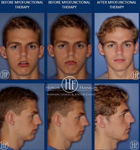 03850436 CF56 447D 95D1 D5E187441188