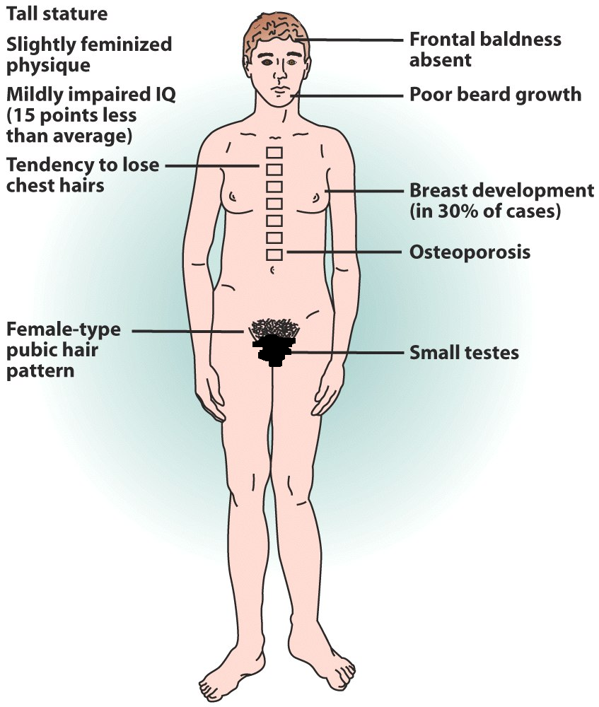 This is who calls you a manlet