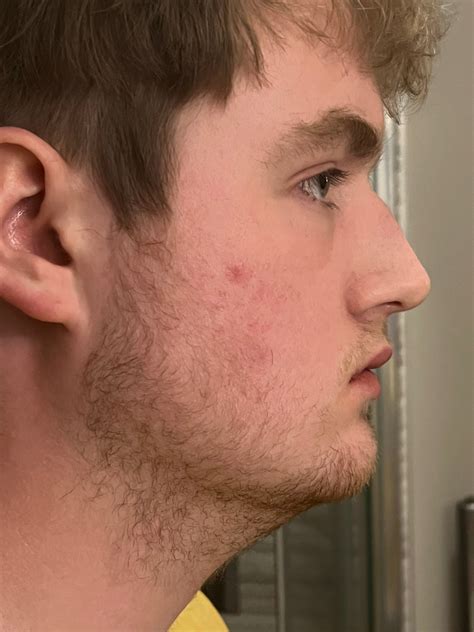 IMG 3821