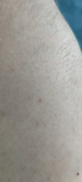 1710013860912