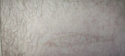1710013868620