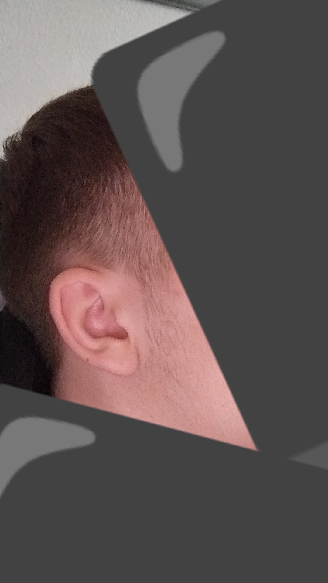 1000181314