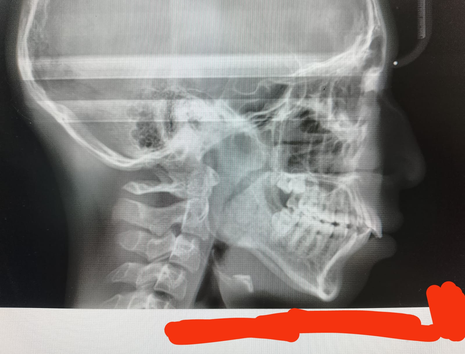 IMG 20240313 111130
