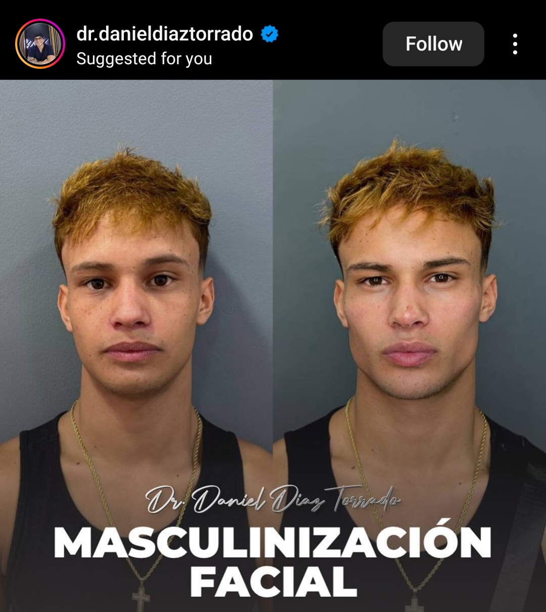 Screenshot 2024 03 13 11 49 46 948 cominstagramandroid edit