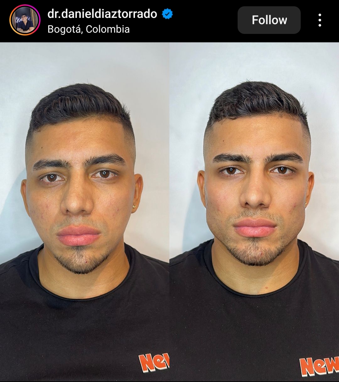 Screenshot 2024 03 13 11 50 13 823 cominstagramandroid edit