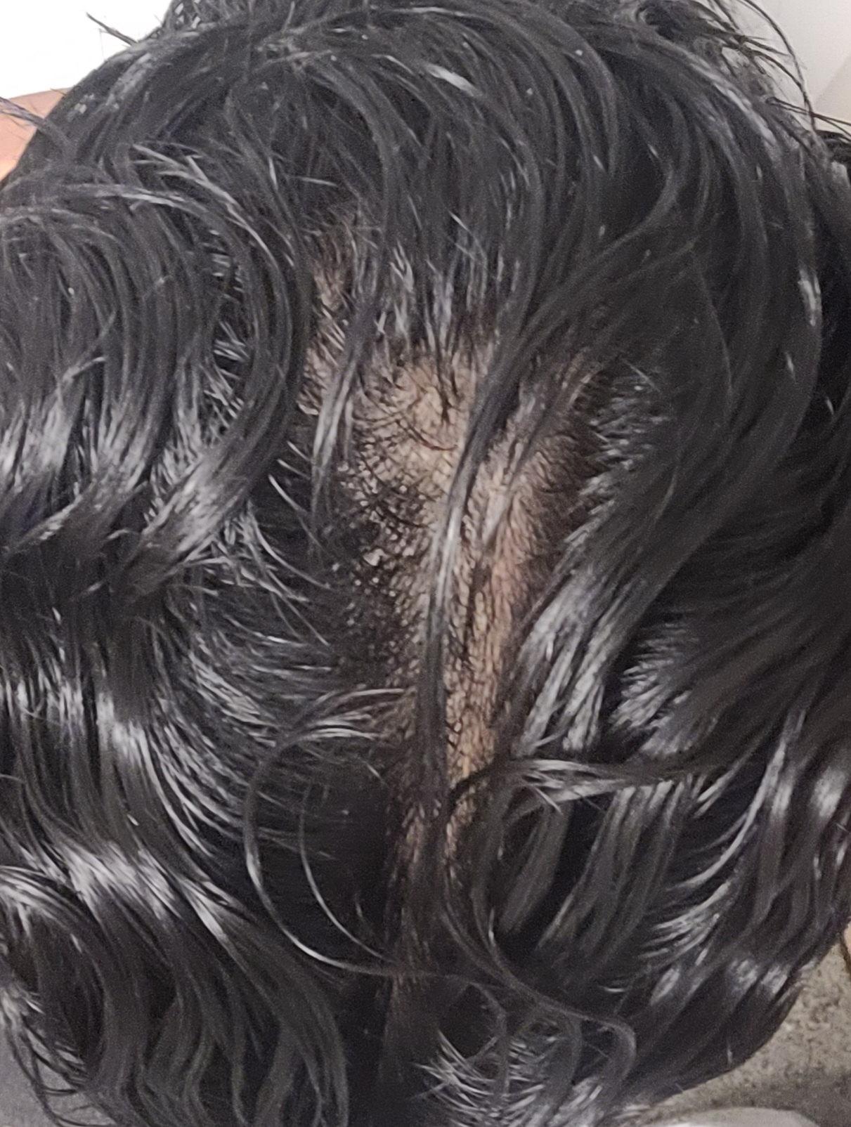 Hair