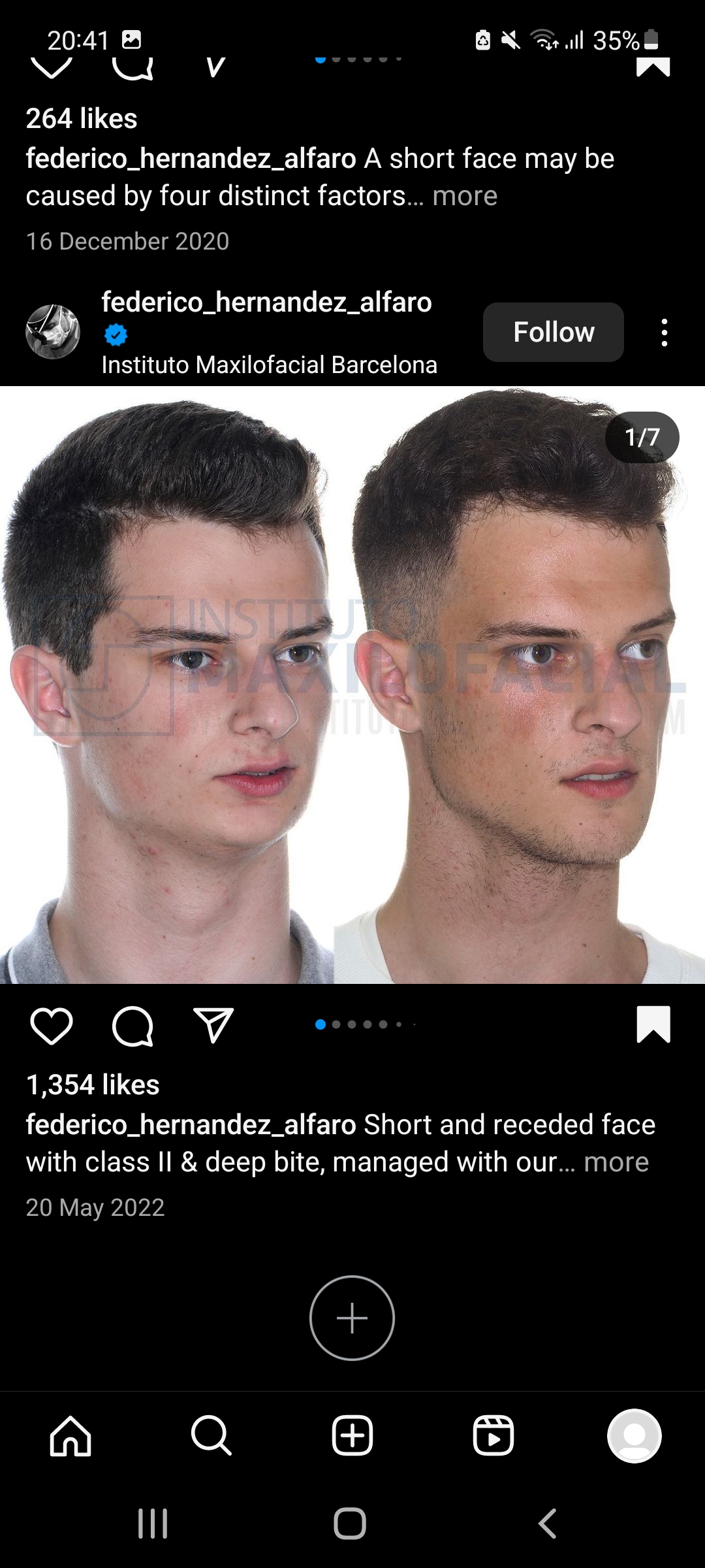 Screenshot 20240313 204149 Instagram