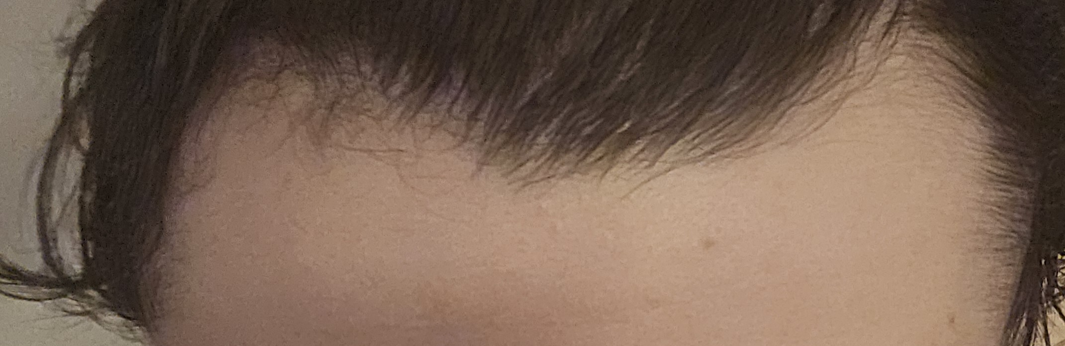 1000022958