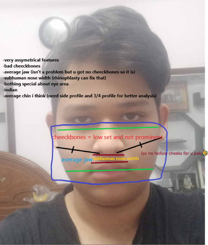 1710554281434
