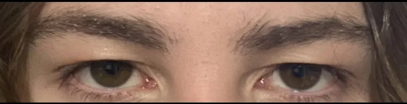 3837033 eyesresults