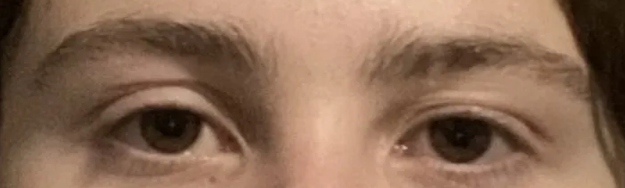 3837032 eyesbefore