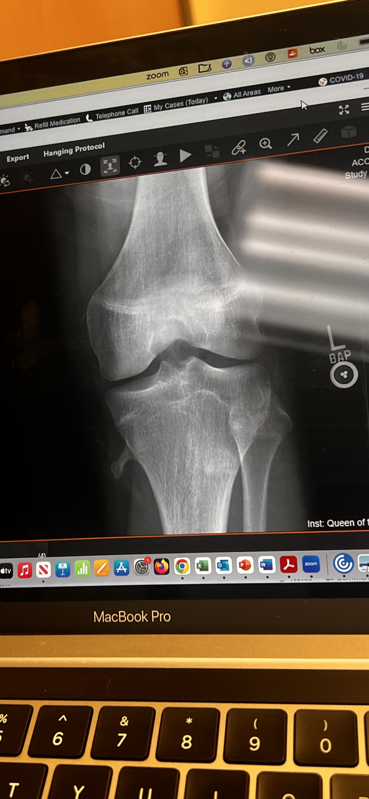 EF419560 48E8 4558 AFA5 D7741E1D43EA