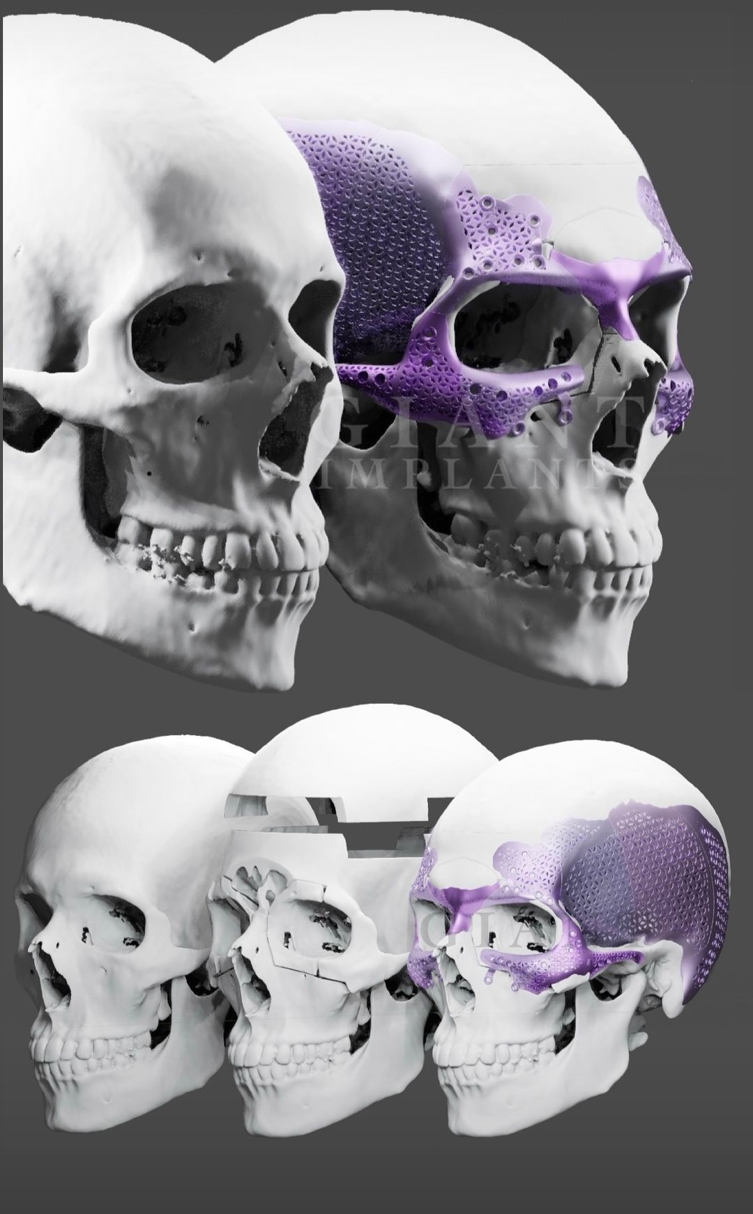1000002843